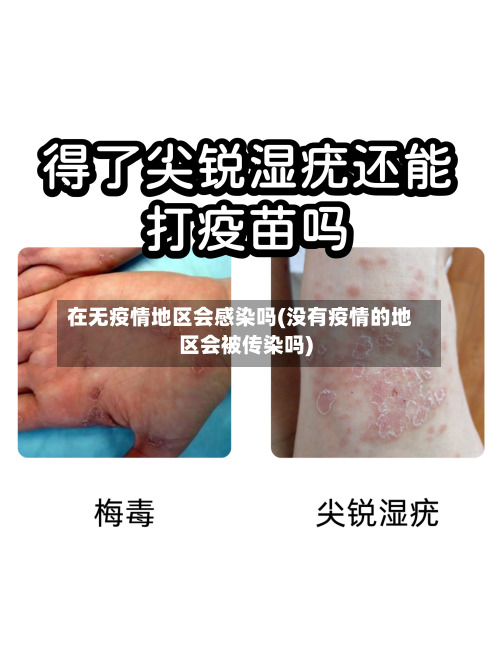 在无疫情地区会感染吗(没有疫情的地区会被传染吗)-第2张图片
